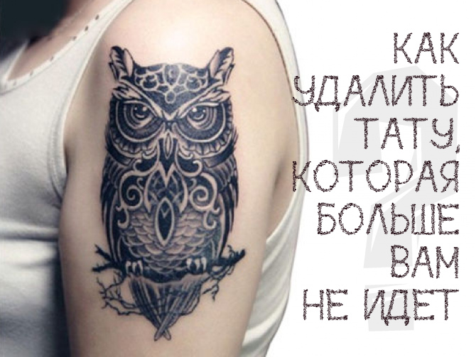 удаление татуировки лазером