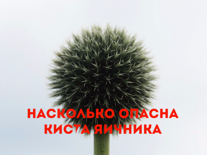 Киста яичника, симптомы и последствия, виды кист яичника