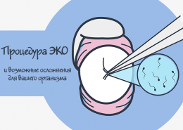 Процедура ЭКО и возможные осложнения для вашего организма