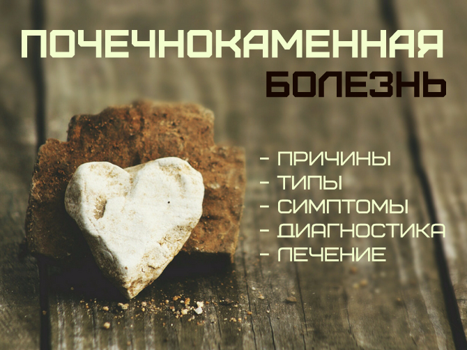 Почечнокаменная болезнь