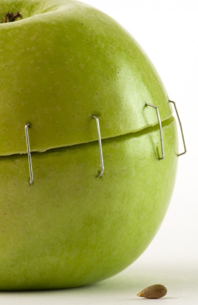 Келоидные и гипертрофические рубцы лечение, коррекция