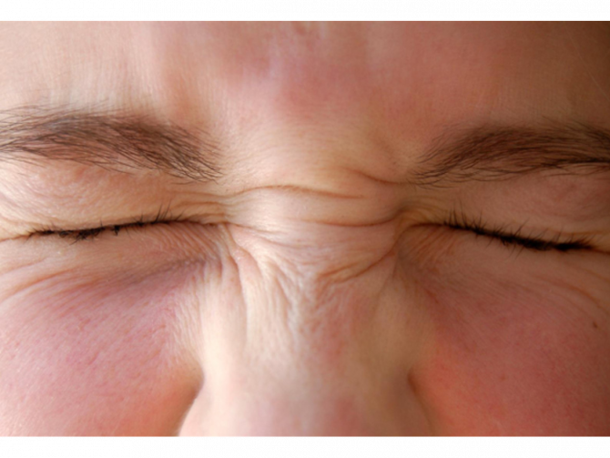 wrinkle skin