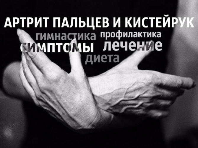 Артрит пальцев и кистей рук: виды, симптомы, причины, лечение, профилактика